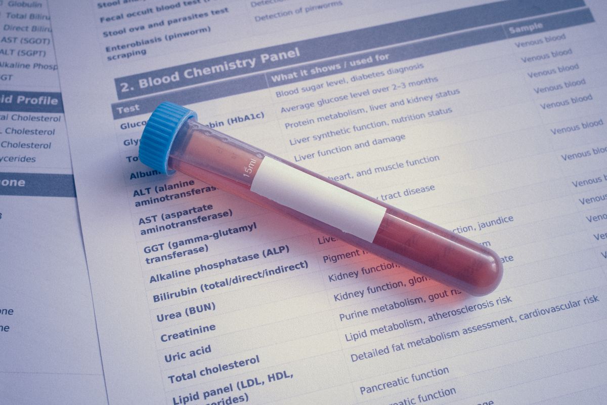 Comprehensive Hormone Mapping