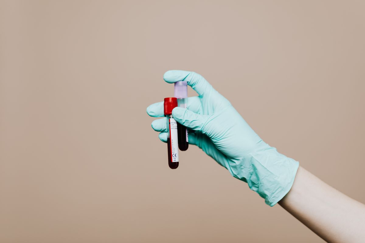 Testosterone Optimization