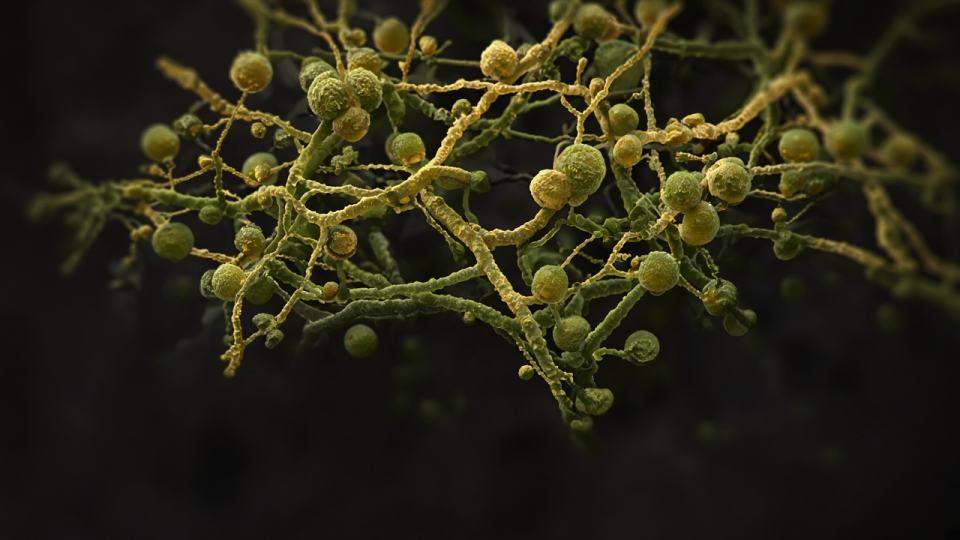 Mycotoxins from Mold Exposure