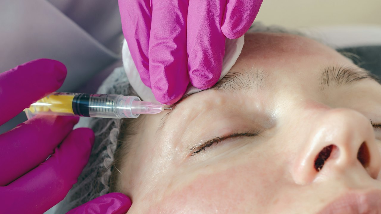 Mesotherapy: Targeted Micro-Injections